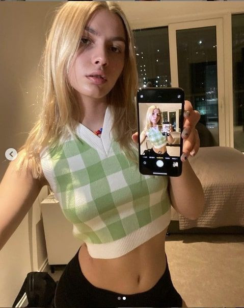 Aleyna Tilki intihar açıklaması yaptı dudakları her şeyin önüne geçti estetikle... - Resim: 3