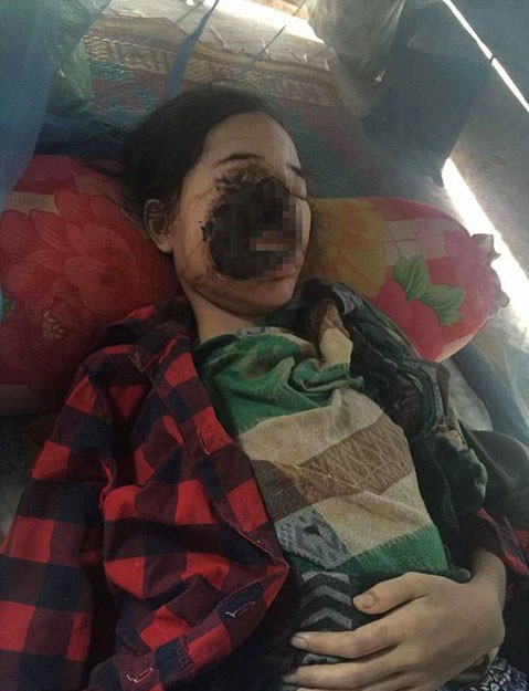 Diş çektirmeye gitti yüzünün yarısını kaybetti inanılmaz olay! - Resim: 4