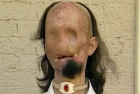 İşte baştan yaratılan o adam! - Resim: 1