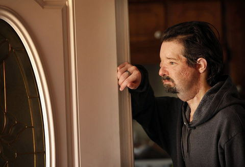 Nakilden bir yıl sonra ilk öpücük - Resim: 3