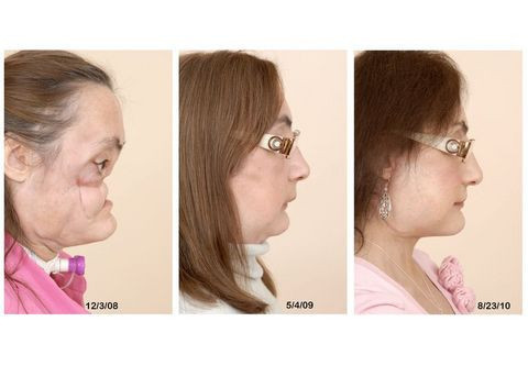 Nakil yüzüne ilk makyajını yaptı - Resim: 3