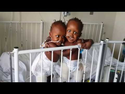 İkizlerin hayatı için büyük mucize tam 50 doktor... - Resim: 4