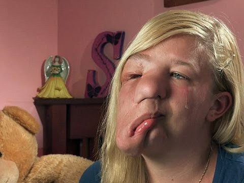 Bu hali dalga  konusuydu ama o öyle bir değişti ki resmen şok - Resim: 4