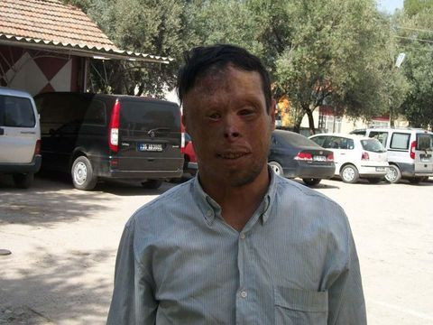 Bu yüze çok dikkatli bakın! - Resim: 2