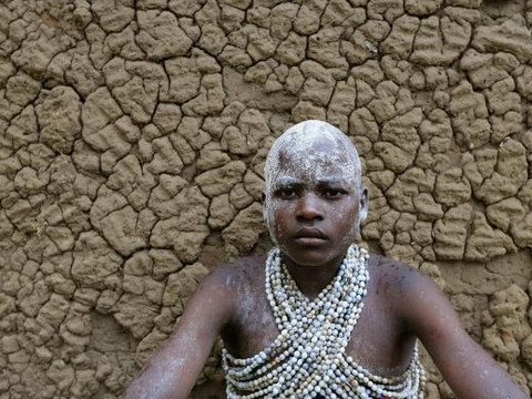 Böyle sünnet töreni görülmedi - Resim: 2