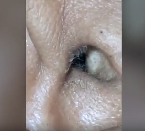 Kulaklarından öyle şeyler çıktı ki görenler hayret etti - Resim: 2