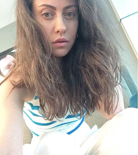 Derya Uluğ anoreksiya mı kemikleri sayılıyor son hali sevenlerini korkuttu - Resim: 4