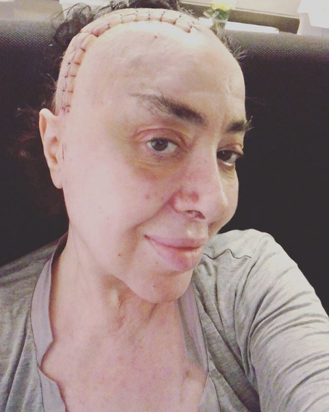 Beyin kanseri teşhisi konan Nur Yerlitaş'a bir fotoğraf paylaşınca mesaj yağdı - Resim: 2