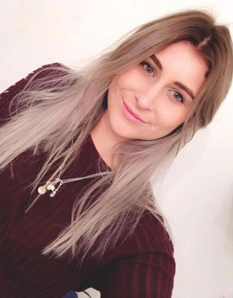 Feci ölüm! Selfie çekeyim derken zemine çakıldı - Resim: 2