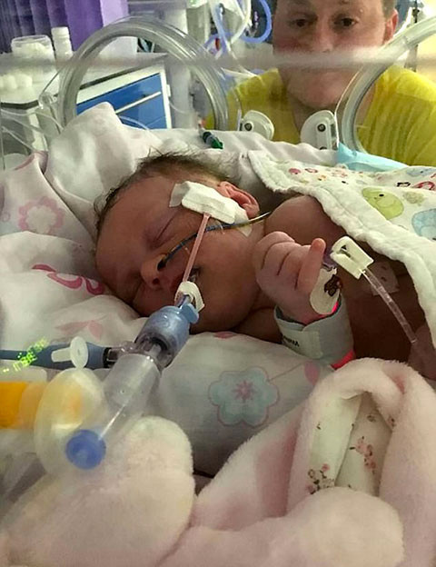 Bu halde dünyaya geldi annesi dehşete düşüp streç filmle... - Resim: 4