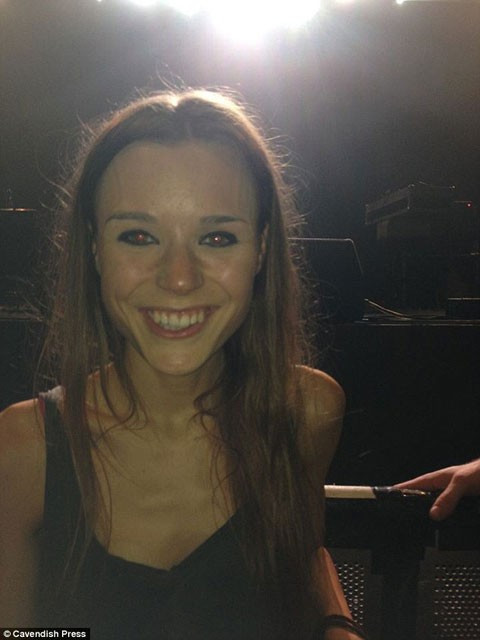 Kendall Jenner gibi olmak isterken ölüyordu - Resim: 3