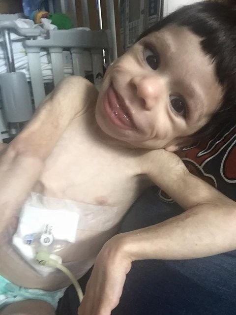 İskelet çocuğun inanılmaz değişimi ölümden döndü - Resim: 3