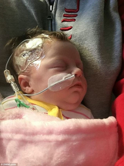 Bebeğin bağırsakları dışarıda doğdu - Resim: 2