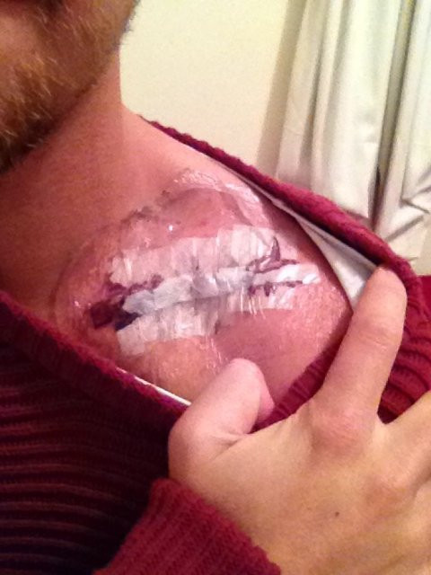 Vücudundan çıkarılan platinle öyle bir şey yaptı ki... - Resim: 3