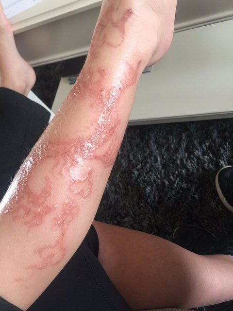 Sizin de başınıza gelebilir! - Resim: 1