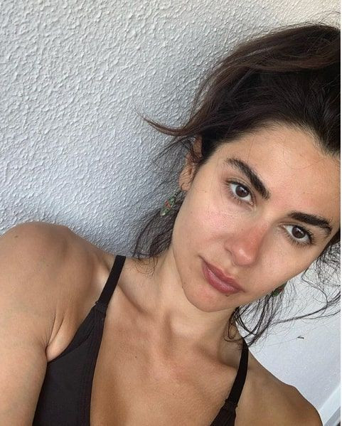 Yasak Elma yıldızı Nesrin Cavadzade ilk kez anlattı: Gözümün altına demir saplandı - Resim: 2