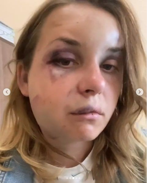 Ünlü sunucuya oğlunun yanında tecavüz etmeye çalışıp dövdü - Resim: 4