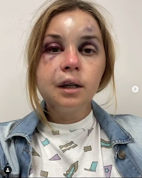 Ünlü sunucuya oğlunun yanında tecavüz etmeye çalışıp dövdü - Resim: 3