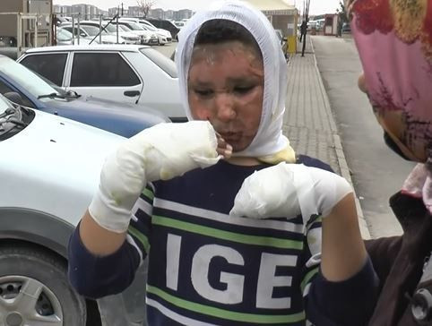 Gaziantep'te oyun korkunç şekilde bitti! Bomba gibi patladı alevler metrelerce yükseldi: Oğlumu tanıyamadım - Resim: 1