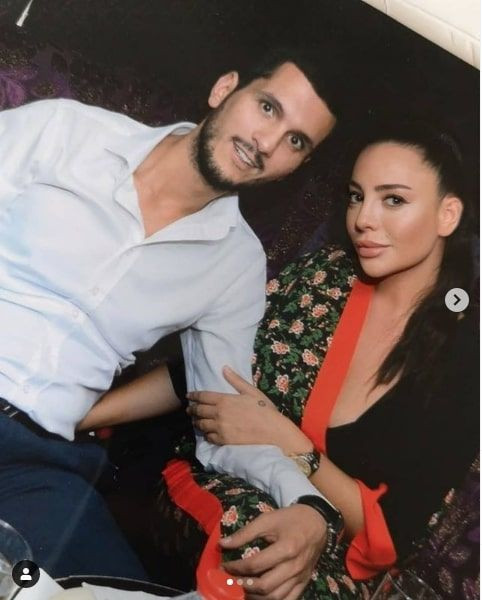 MasterChef Suna Aydın 'ufak dokunuşlar' dedi ama estetikli halini gören şaştı kaldı - Resim: 3