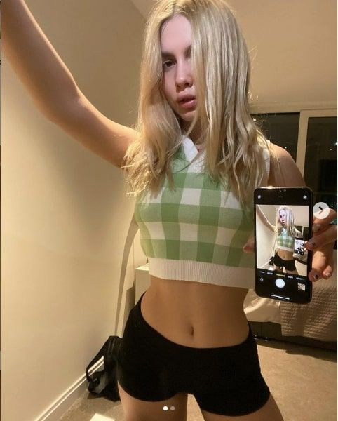 Aleyna Tilki intihar açıklaması yaptı dudakları her şeyin önüne geçti estetikle... - Resim: 1