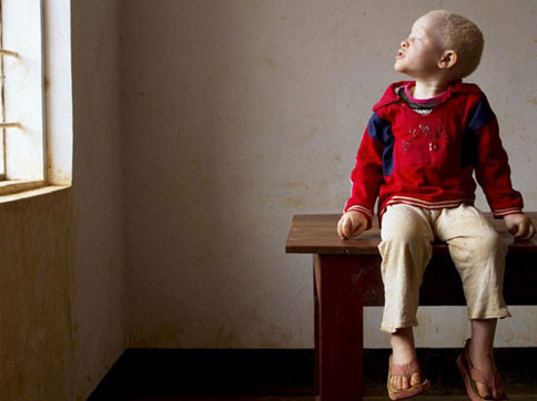 Öldürüp bedenlerini satıyorlar - Resim: 3