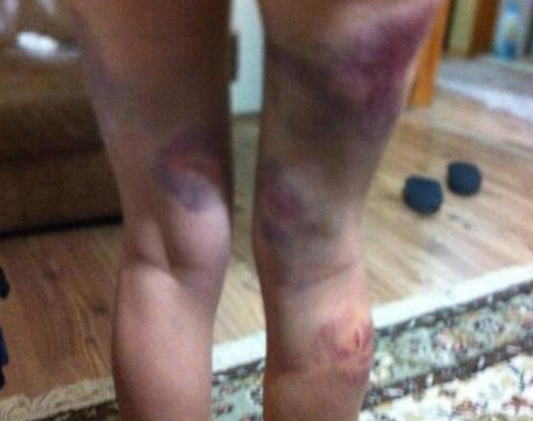 Twitter'dan dayak fotoğraflarını paylaştı - Resim: 2