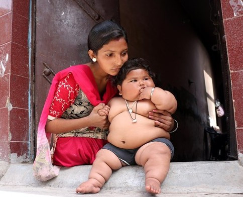 Bu bebek 8 aylık! 4 yaşındaki çocukla aynı kiloda - Resim: 3