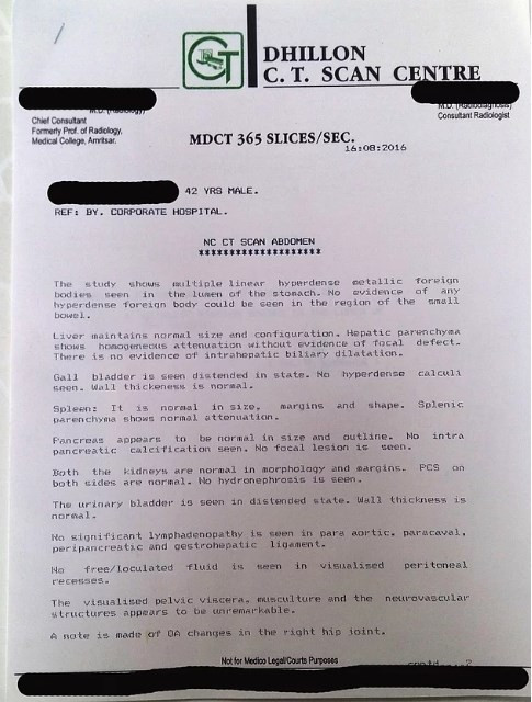 Midesinden 40 adet bıçak çıkartıldı! - Resim: 4