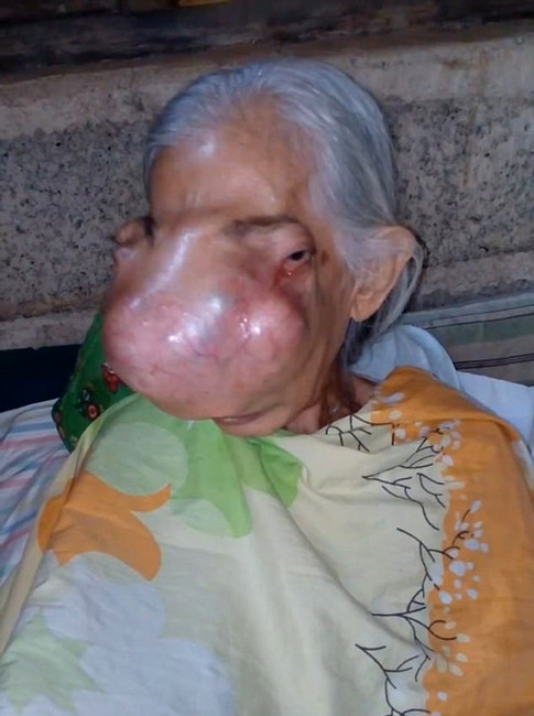 Yaşlı kadın iki yıl içerisinde bu hale geldi gören kaçıyor ama... - Resim: 4