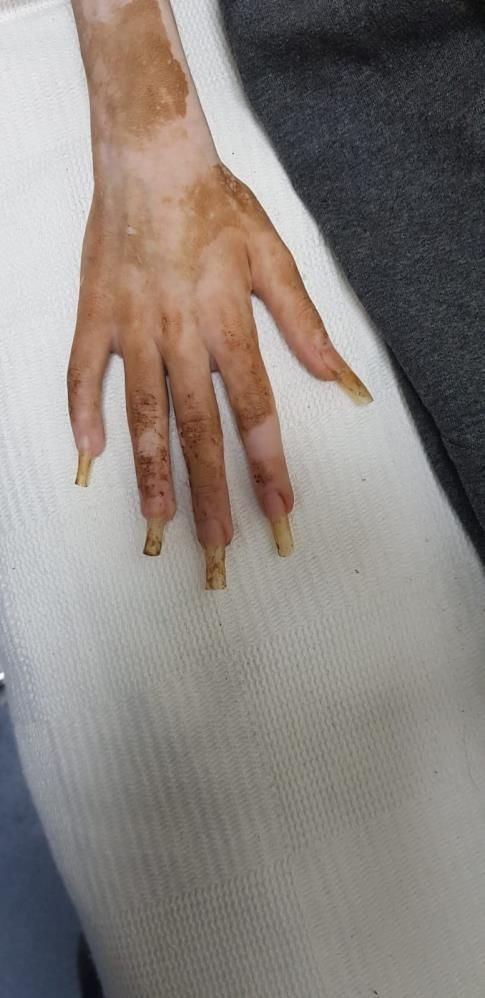 Çöp evde bulunan Cem Muhammed'den güzel haber! 3 kilo aldı taburcu oluyor - Resim: 3