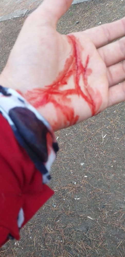 Ordu'da röportajda şiddet terörünü anlattı! Saatler sonra morga cesedi teşhise gitti - Resim: 2