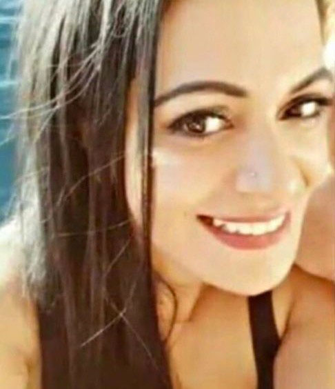 İstanbul Sarıyer'de iki elti arasındaki kıskançlık kavgası kanlı bitti güzel diye ağzından vurdu - Resim: 1