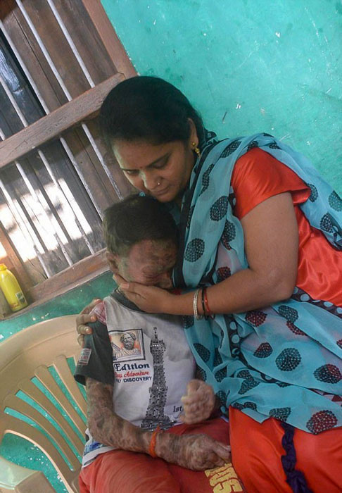 16 yaşındaki 'Yılan kız' dünyayı hayrete düşürdü - Resim: 2