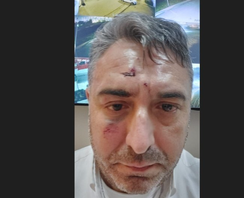 İş adamı 3 saat boyunca kabusu yaşadı! Özel hastane sahibi dövdü, pansuman yaptırıp gönderdi - Resim: 1