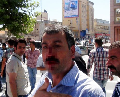 Fakıbaba'nın güvenlikleri vatandaşı hastanelik etti - Resim: 2