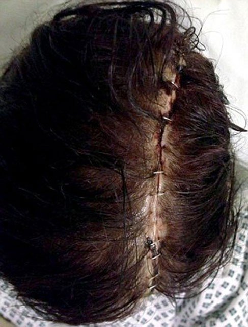 Dikkat! Doğum kontrol hapı kullandı hayatının kabusunu yaşadı - Resim: 4