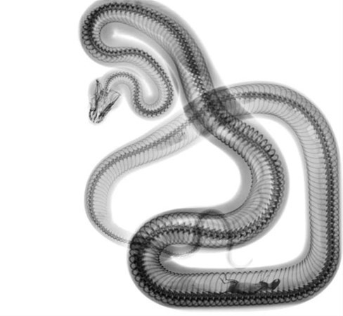 Röntgende her şey görüntülendi! İçine soktuğu şişe mideden çıktı - Resim: 4