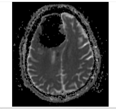 Baş ağrısı diye hasteneye gitti beyinsiz çıktı! - Resim: 3