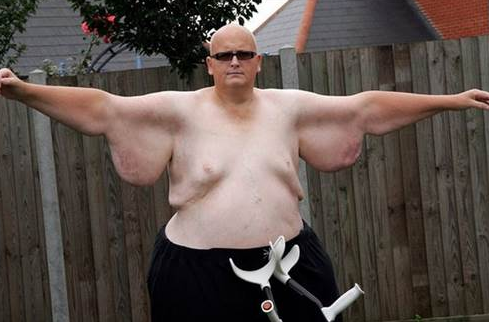 Bu adam imkansızı başardı - Resim: 4