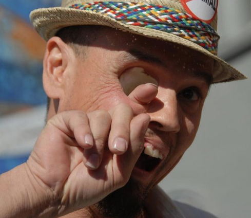 Bu insanlar mucize eseri yaşıyor - Resim: 4