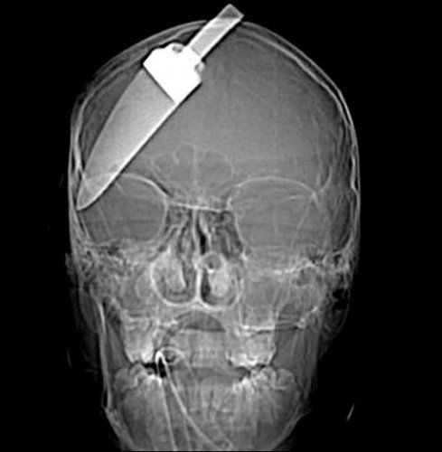 Bu röntgenler çok şaşırtacak  - Resim: 1
