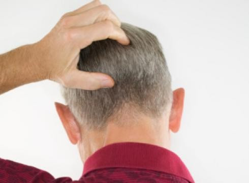 Unutkanlık hastalık haline geldiyse... - Resim: 2