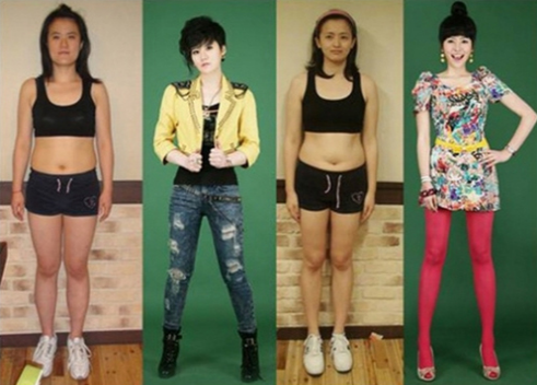 Estetikle öyle değiştiler ki! - Resim: 1