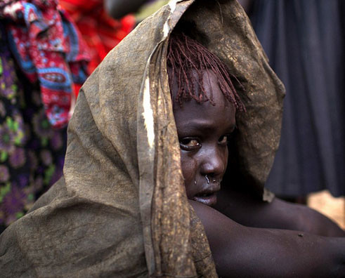 Afrika'da kadın sünneti - Resim: 1