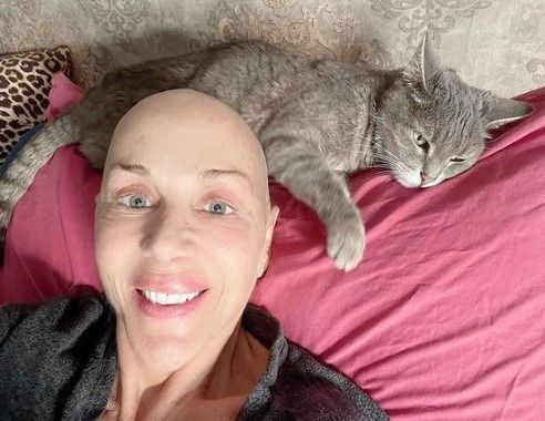 Kanserle mücadele eden Billur Kalkavan, sağlık durumu hakkında önemli açıklamalar yaptı: ''Böylesi daha kolaymış'' - Resim: 4