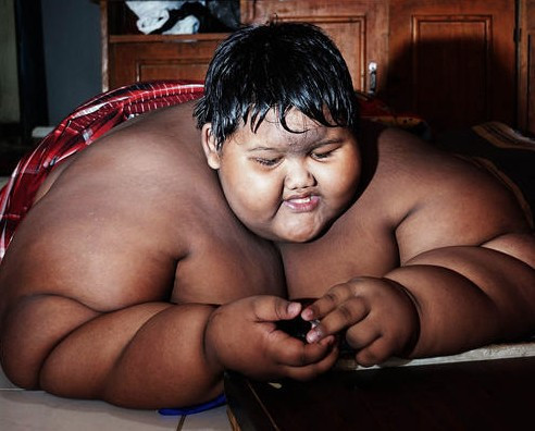 Günde 5 öğün pilav yiyerek bu hale geldi! Şuna bakın... - Resim: 1