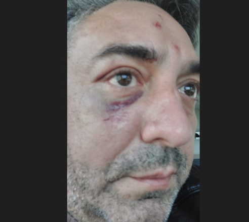 İş adamı 3 saat boyunca kabusu yaşadı! Özel hastane sahibi dövdü, pansuman yaptırıp gönderdi - Resim: 4