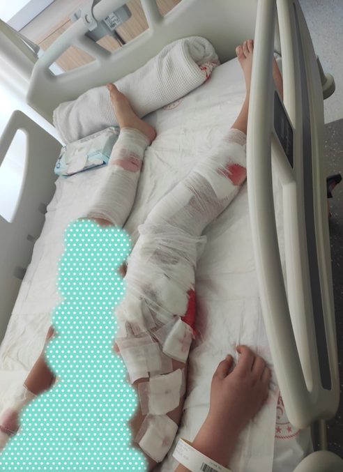 Bursa'da okula giderken 8 köpek saldırdı 80 dikiş atıldı bir motosikletli dalıp kurtardı - Resim: 4