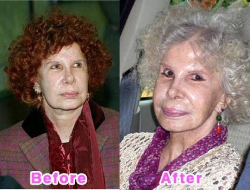 Ünlülerin estetik faciası! - Resim: 4